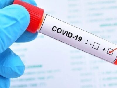 COVID-19: NCDC records lowest infection figure in more than 1 year