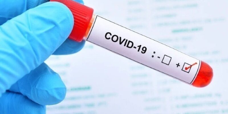 COVID-19: NCDC records lowest infection figure in more than 1 year