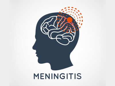 MENINGITIS: EVERYTHING YOU NEED TO KNOW