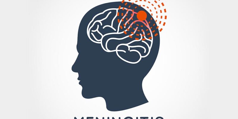 MENINGITIS: EVERYTHING YOU NEED TO KNOW