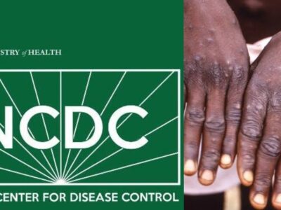 Monkeypox cases rise to 157 in Nigeria