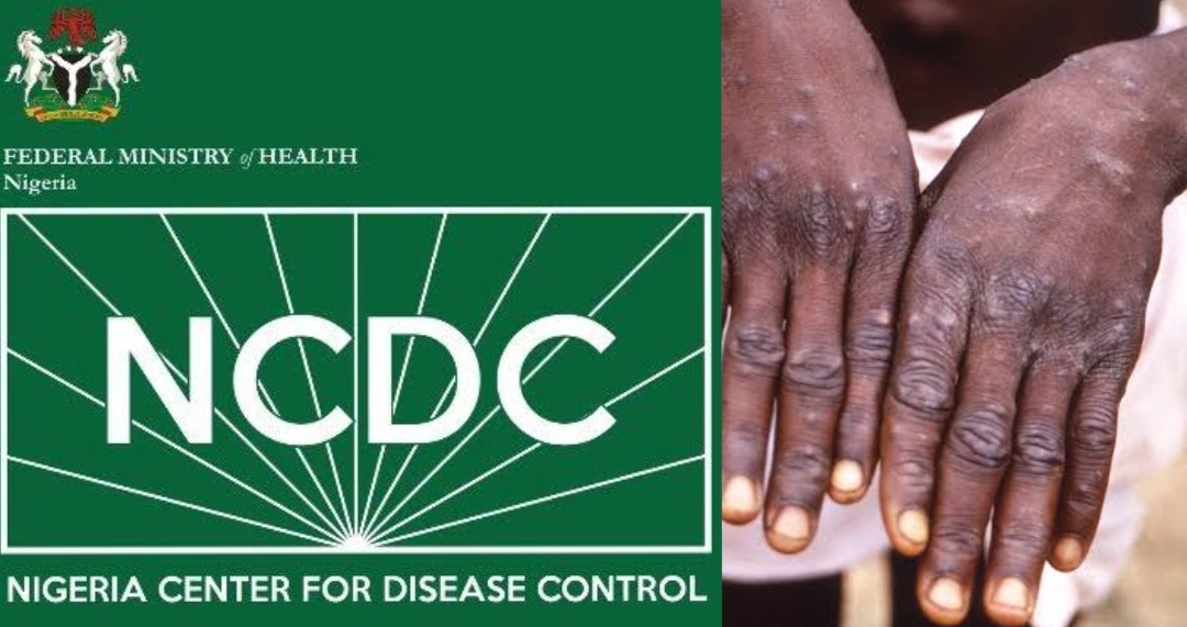 Monkeypox cases rise to 157 in Nigeria