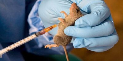 Lassa Fever: NCDC confirms 37 deaths in three weeks