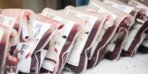 Train/Bus Accident: Lagos residents donate 300 units blood