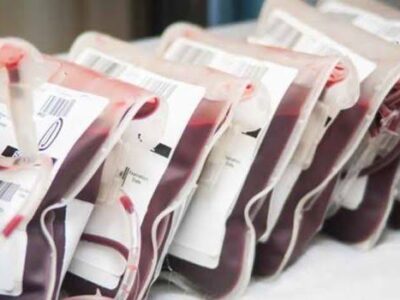 Train/Bus Accident: Lagos residents donate 300 units blood