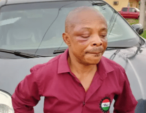 I-Was-beaten-Black-And-Blue-NLC-President-Ajaero-Narrates-Ordeal-In-Police-Custody